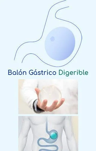 Balon gastrico digerible ecuador