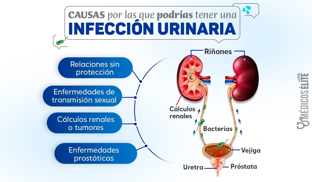 Causas De Las Infecciones Urinarias