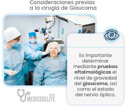 Consideraciones previas cirugia glaucoma