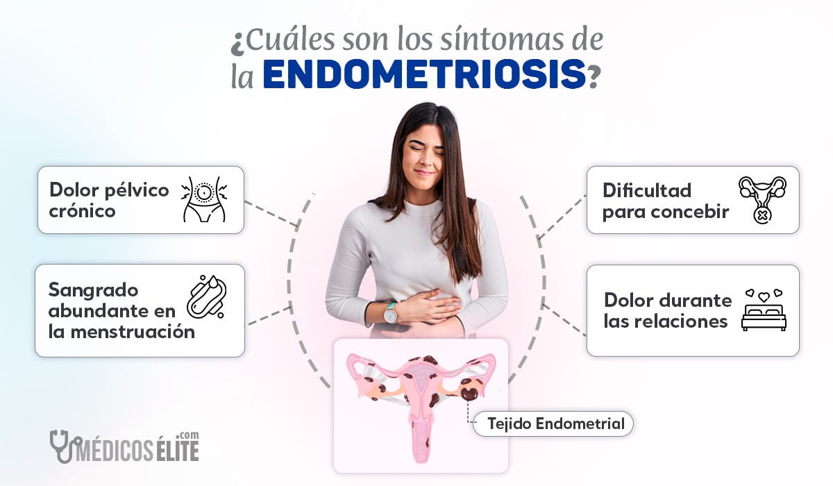 Endometriosis Síntomas Diagnóstico Y Tratamientos 9189