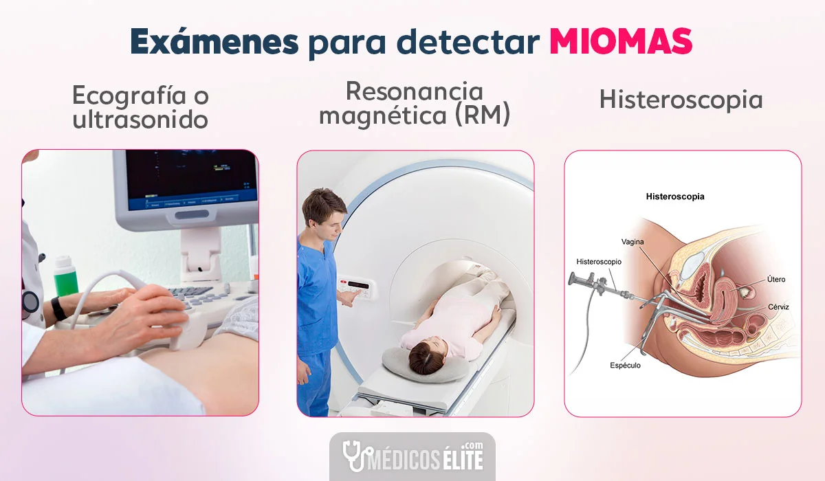 Exámenes para detectar miomas