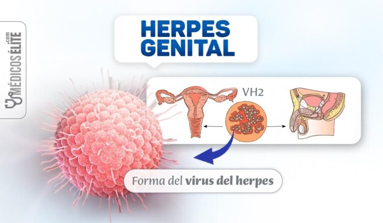 Herpes Genital