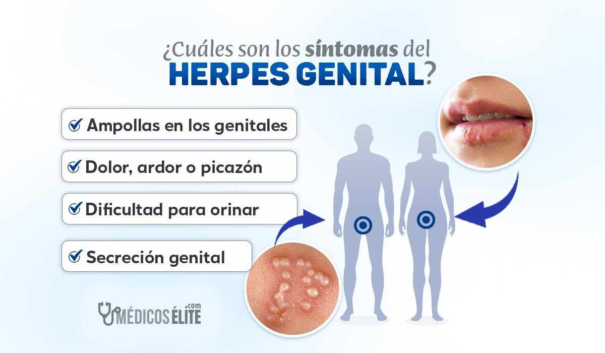 Síntomas De Los Herpes Genitales