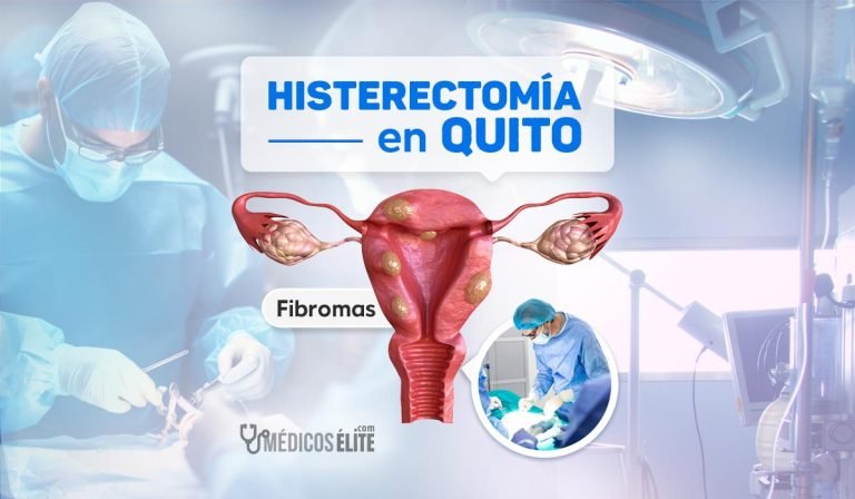 Histerectomía para eliminar Fibromas Uterinos