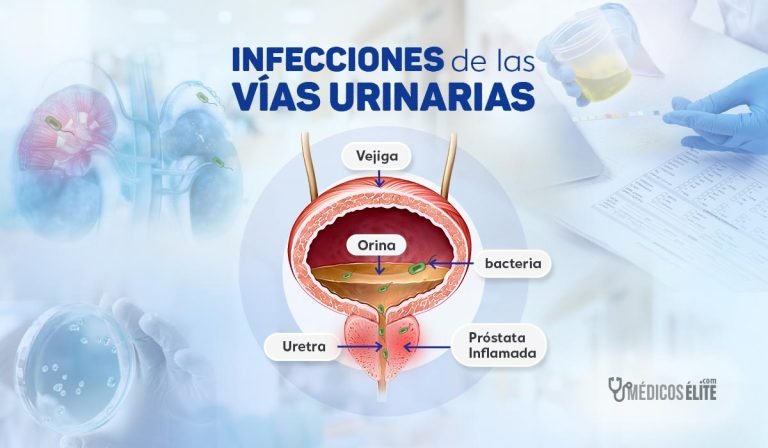 Infecciones de las Vías Urinarias