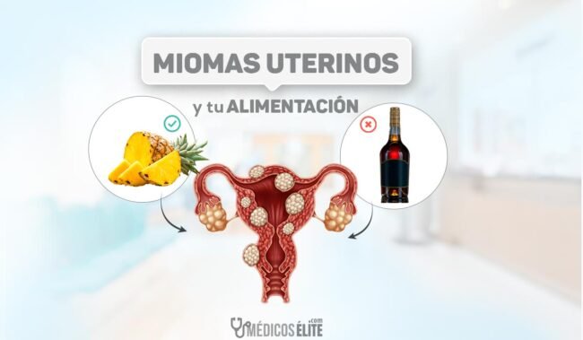 Miomas uterinos y tu alimentación