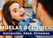 Extracción de Muelas del Juicio en Quito