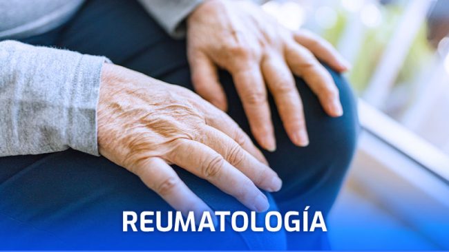 reumatologia-artritis-lupus