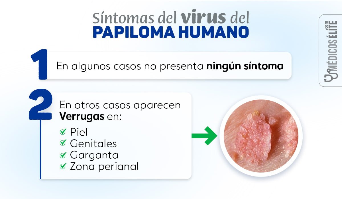 Síntomas Virus Del Papiloma Humano