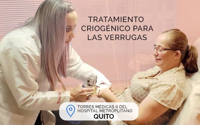 Tratamiento criogenico para verrugas