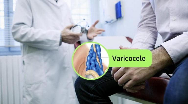 Como afecta el varicocele al hombre