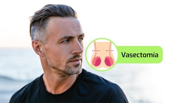 Vasectomía, un anticonceptivo seguro